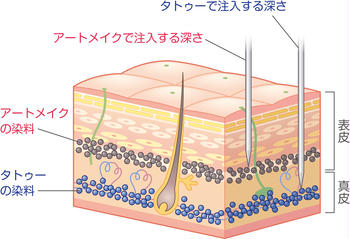 ピコ秒レーザーによるアートメイクの除去方法と効果的な施術回数 リスクやダウンタイム Kirei