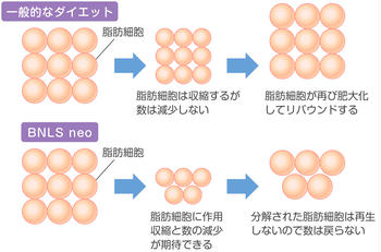 溶脂针bnls Neo注射在脸和身体后期待的效果和危险性 恢复期 Kirei