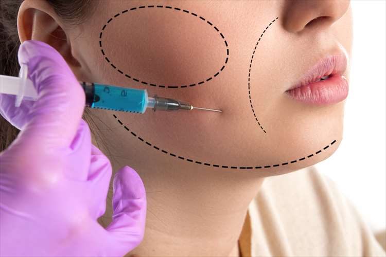 Inyección de disolución de grasa en la cara.