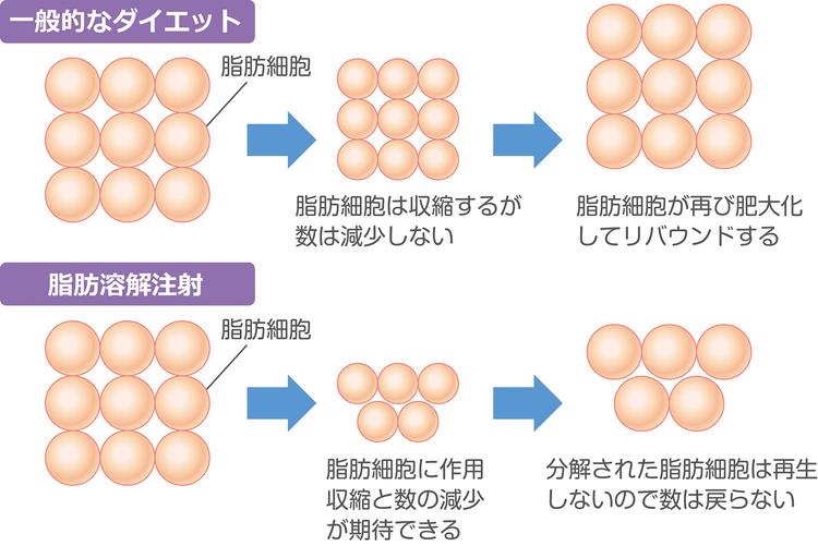 เซลล์ไขมันที่ลดลงโดยการฉีด lipolytic จะไม่สร้างใหม่