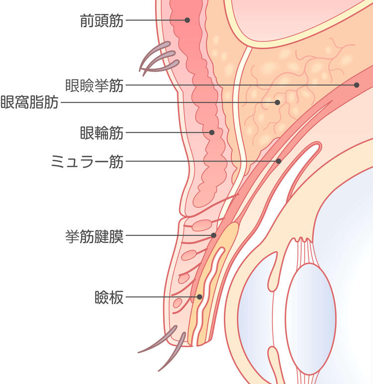 Sitios relacionados con la cirugía realizada en combinación con la incisión del canto interno