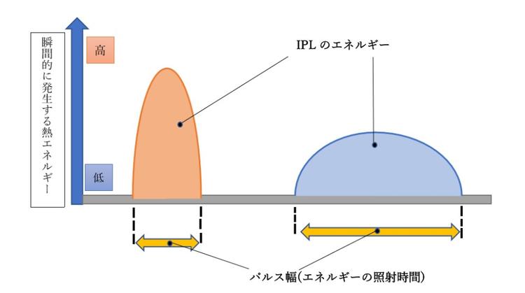 IPL pulse width