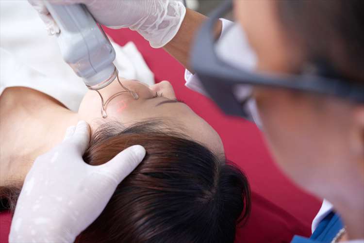 Princípios do tratamento a laser em medicina de beleza e tipos de lasers para melhorar manchas e cicatrizes de acne