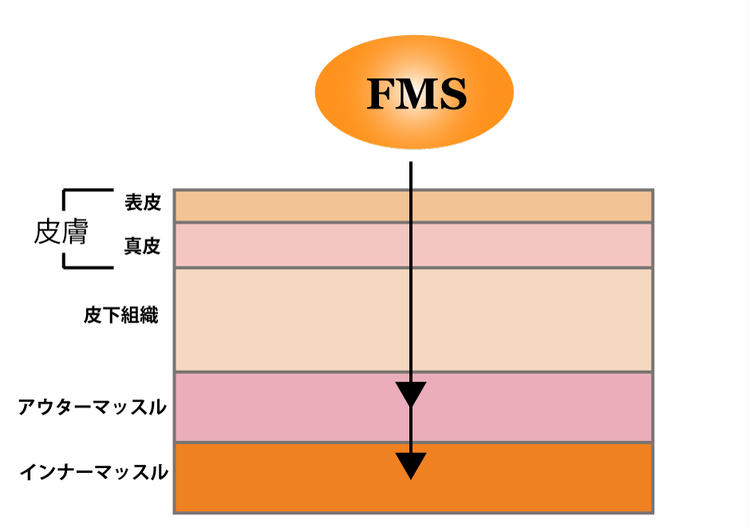 テスラフォーマーで筋肉増強を目指せる仕組み_FMSの作用イメージイラスト