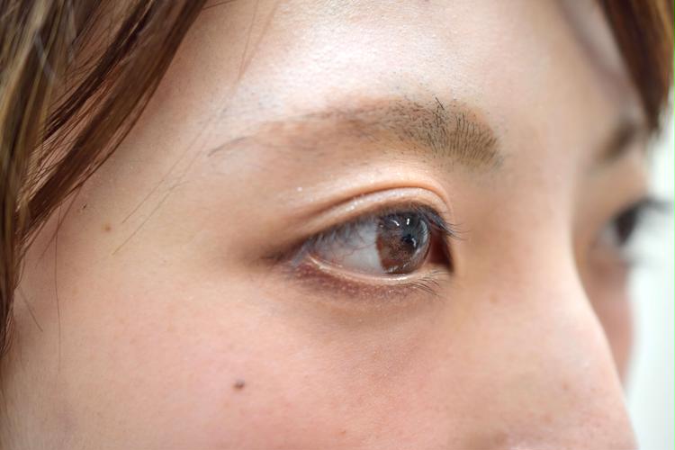 Woman with double eyelids
