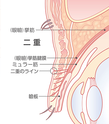 Membrana tendinea muscolare elevata