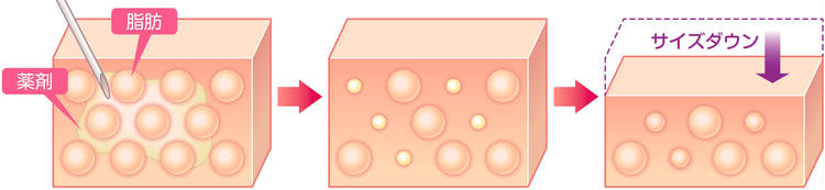 Illustration of the action of BNLS neo on adipocytes