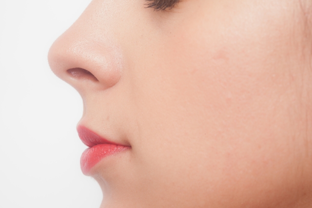 Benefícios, tempo de inatividade, risco e precauções obtidas ao estender o septo nasal