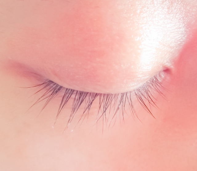 Wirkung der BNLS-Injektion auf das Augenlidfett