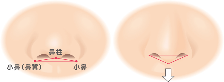 Descripción de la columna nasal.