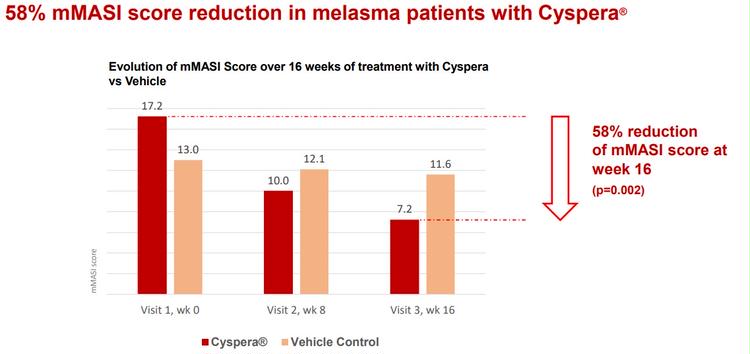 A 58% reduction in melasma area was shown