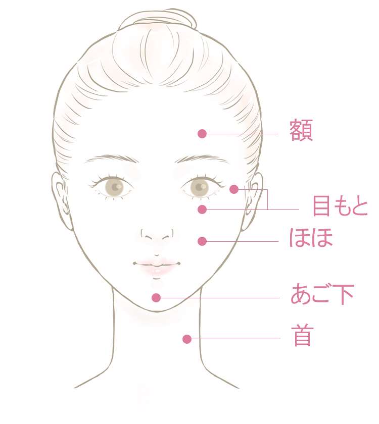 Bereiche, die mit Ultracell Q Plus im Gesicht behandelt werden können
